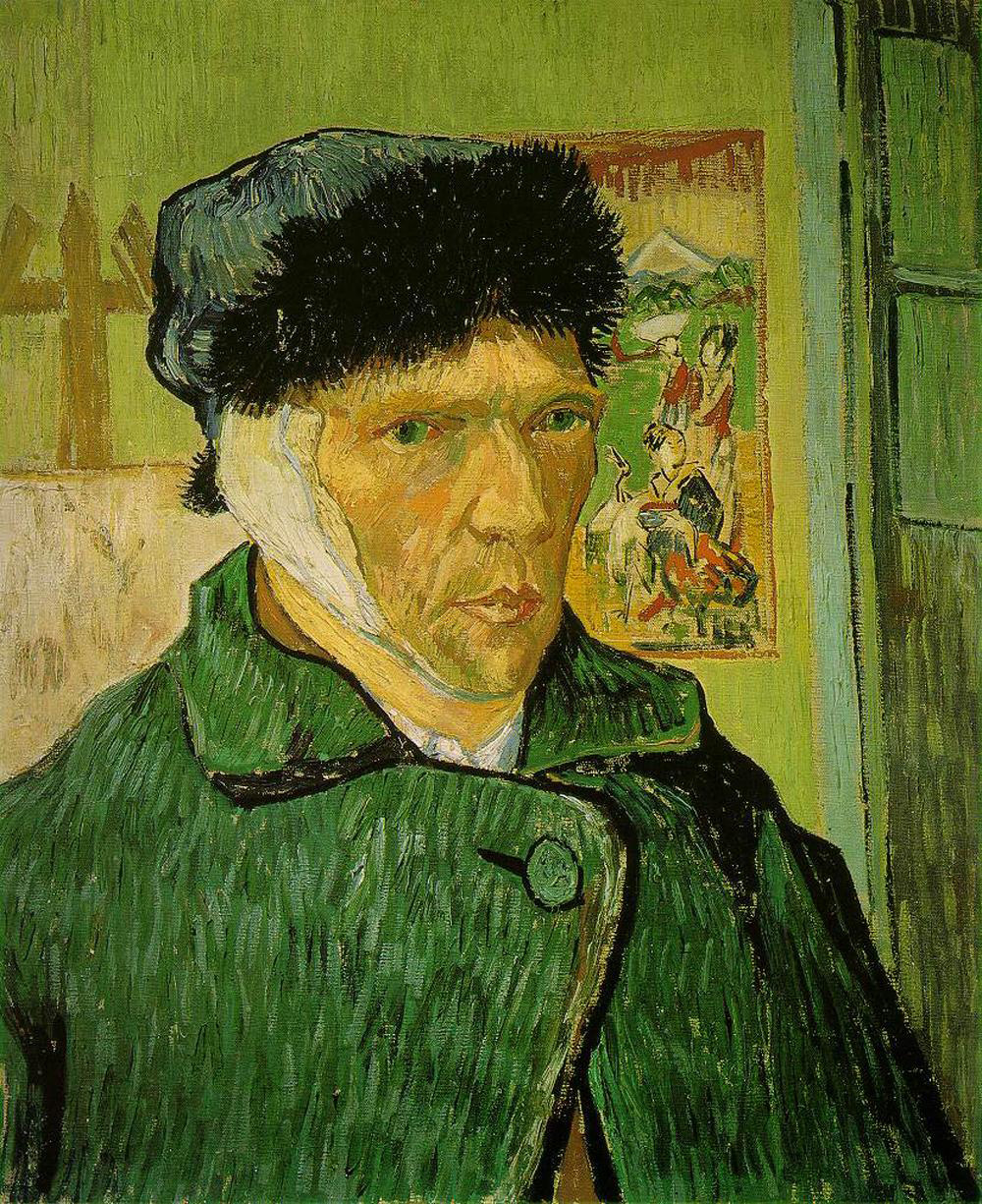Plan de coupe sur l'oreille de Van Gogh 