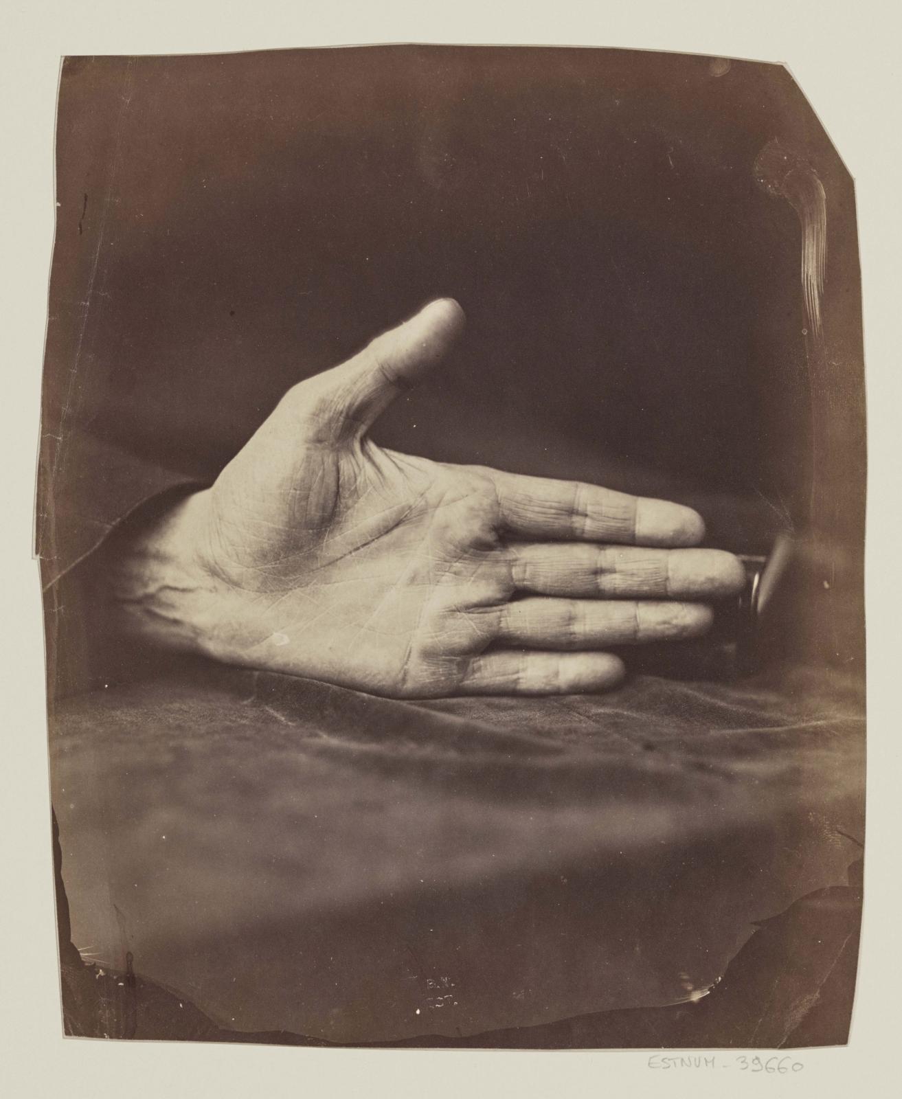 Félix Nadar, Main du banquier, cliché obtenu à la lumière diurne. Épreuve tirée à la lumière électrique, 1861, BnF, département des Estampes et de la 
